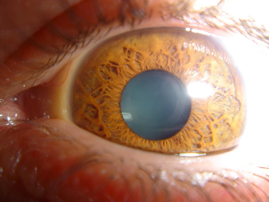 eecue's eye